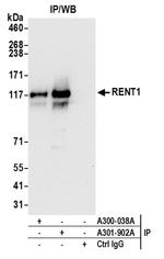 RENT1 Antibody in Western Blot (WB)