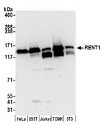 RENT1 Antibody in Western Blot (WB)