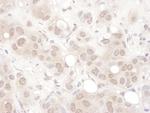 REST Antibody in Immunohistochemistry (IHC)