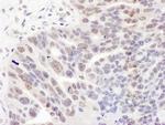 REST Antibody in Immunohistochemistry (IHC)