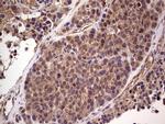 RET Antibody in Immunohistochemistry (Paraffin) (IHC (P))