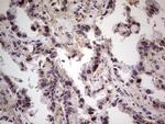 RET Antibody in Immunohistochemistry (Paraffin) (IHC (P))