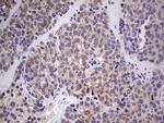 RET Antibody in Immunohistochemistry (Paraffin) (IHC (P))