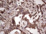 RET Antibody in Immunohistochemistry (Paraffin) (IHC (P))