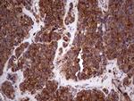 RET Antibody in Immunohistochemistry (Paraffin) (IHC (P))