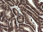 RFC2 Antibody in Immunohistochemistry (Paraffin) (IHC (P))