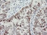 RFC2 Antibody in Immunohistochemistry (Paraffin) (IHC (P))