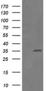 RFC2 Antibody in Western Blot (WB)