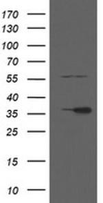 RFC2 Antibody in Western Blot (WB)