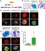 RFP Antibody in Immunohistochemistry (IHC)
