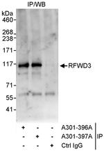 RFWD3 Antibody in Immunoprecipitation (IP)