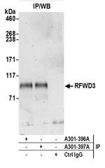 RFWD3 Antibody in Western Blot (WB)