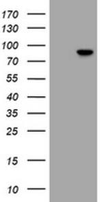 RFX3 Antibody in Western Blot (WB)