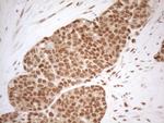 RGL2 Antibody in Immunohistochemistry (Paraffin) (IHC (P))