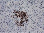 RGS5 Antibody in Immunohistochemistry (Paraffin) (IHC (P))