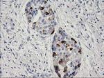 RGS5 Antibody in Immunohistochemistry (Paraffin) (IHC (P))