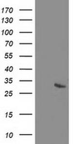 RGS5 Antibody in Western Blot (WB)