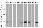 RGS5 Antibody in Western Blot (WB)