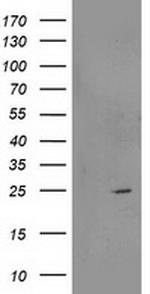 RGS5 Antibody in Western Blot (WB)