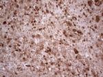 RHOC Antibody in Immunohistochemistry (Paraffin) (IHC (P))