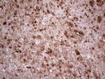 RHOC Antibody in Immunohistochemistry (Paraffin) (IHC (P))