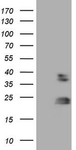 RHOC Antibody in Western Blot (WB)