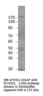 Robo3 Antibody in Western Blot (WB)