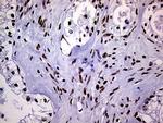 RING1 Antibody in Immunohistochemistry (Paraffin) (IHC (P))