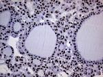 RING1 Antibody in Immunohistochemistry (Paraffin) (IHC (P))