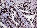 RING1 Antibody in Immunohistochemistry (Paraffin) (IHC (P))