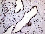 RING1 Antibody in Immunohistochemistry (Paraffin) (IHC (P))