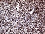 RING1 Antibody in Immunohistochemistry (Paraffin) (IHC (P))