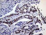 RING1 Antibody in Immunohistochemistry (Paraffin) (IHC (P))