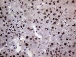 RING1 Antibody in Immunohistochemistry (Paraffin) (IHC (P))