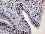 RING1 Antibody in Immunohistochemistry (Paraffin) (IHC (P))