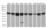 RING1 Antibody in Western Blot (WB)