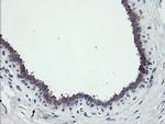 RIPK1 Antibody in Immunohistochemistry (Paraffin) (IHC (P))