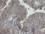 RIPK1 Antibody in Immunohistochemistry (Paraffin) (IHC (P))