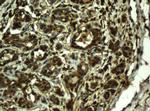 RIPK1 Antibody in Immunohistochemistry (Paraffin) (IHC (P))