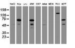 RIPK1 Antibody in Western Blot (WB)