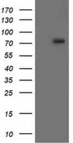 RIPK1 Antibody in Western Blot (WB)