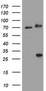 RIPK1 Antibody in Western Blot (WB)