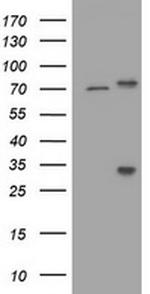 RIPK1 Antibody in Western Blot (WB)