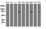 RIPK1 Antibody in Western Blot (WB)