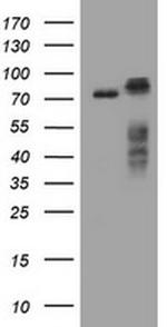 RIPK1 Antibody in Western Blot (WB)