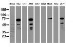 RIPK1 Antibody in Western Blot (WB)