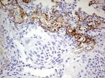 RIPK3 Antibody in Immunohistochemistry (Paraffin) (IHC (P))