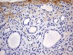 RIPK3 Antibody in Immunohistochemistry (Paraffin) (IHC (P))