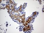 RIPK3 Antibody in Immunohistochemistry (Paraffin) (IHC (P))