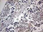 RIPK3 Antibody in Immunohistochemistry (Paraffin) (IHC (P))